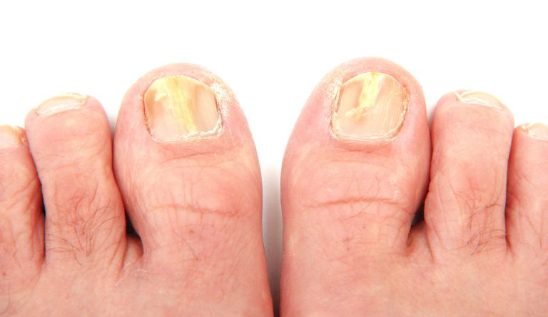 A Podiatrist Keilor Can Trust - Taylors Lakes Podiatry Clinic