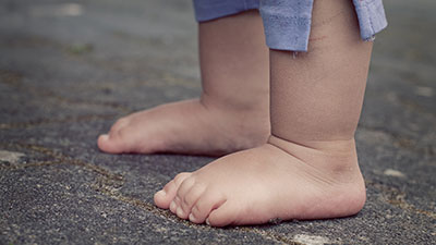 childrens-foot-care-melbourne